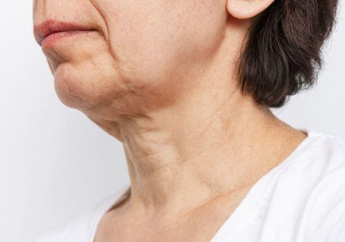 Mature woman's chin beginning to sag.
