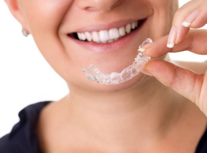 Teeth Straightening Treatment Longevity and Care Tips