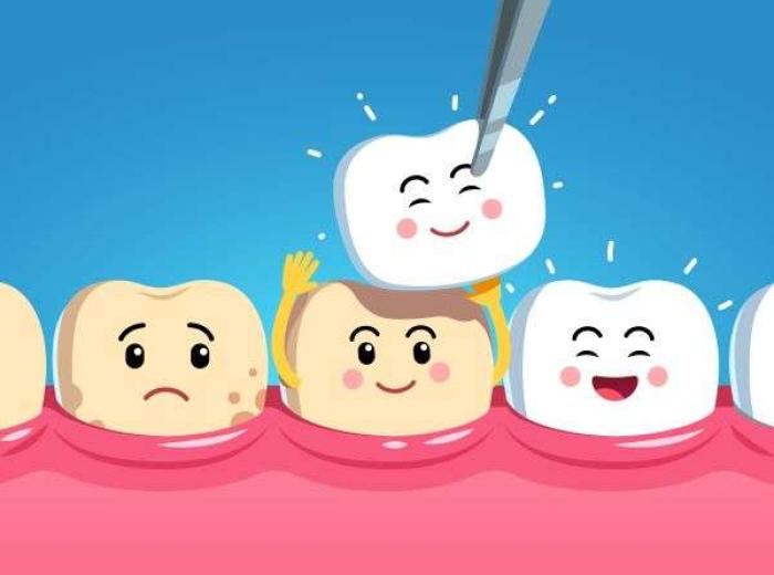 Caring for Porcelain Veneers: Tips for Jenkintown Patients