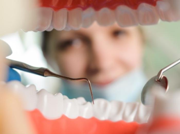 Preventive Benefits of Routine Dental Cleanings