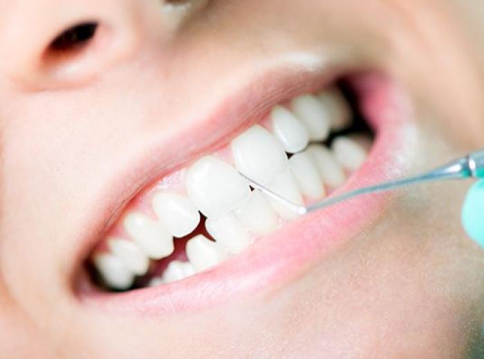 Dental Cleaning & Examinations in Jenkintown