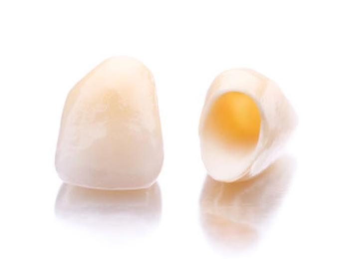 Dental Crowns: Restore Your Smile with Expert Care