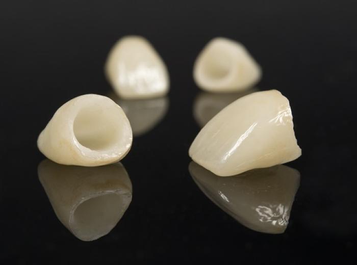Transform Your Smile with Dental Crowns