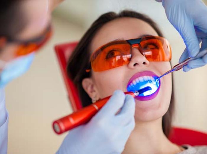 Treat Cavities with Dental Fillings for Optimal Oral Health