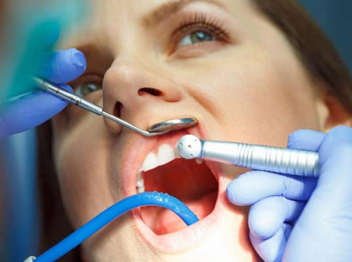 4 Dental Restoration Options for Damaged Teeth