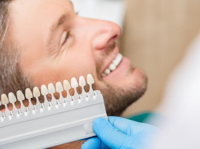 Dental Veneer Process: How Teeth Are Prepared for Veneers