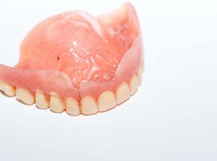 Denture Reline Procedure: Comfort & Care