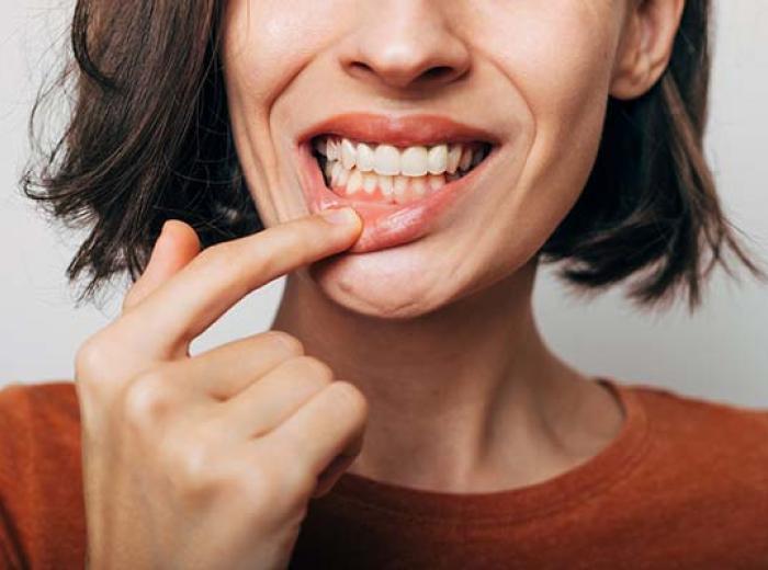Gum Disease Awareness: Symptoms & Prevention Tips