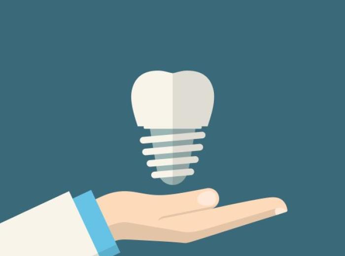 Dental Implant Placement in Jenkintown: Who to Choose?