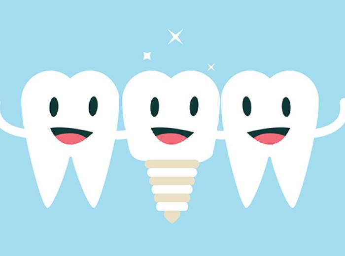 Dental Implant Aftercare: Essential FAQs & Tips