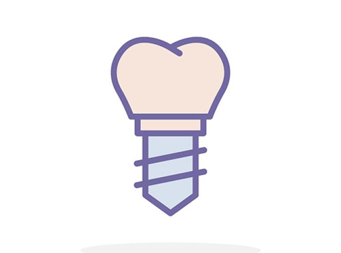 Dental Implants: Fixed vs. Removable Restorations Explained