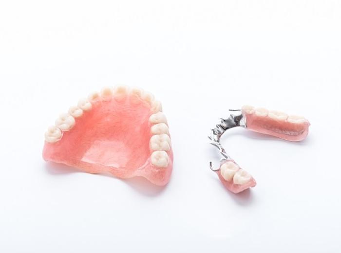 Discover Implant Supported Dentures