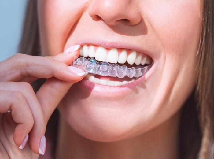 Invisalign Treatment in Jenkintown for Teeth Alignment