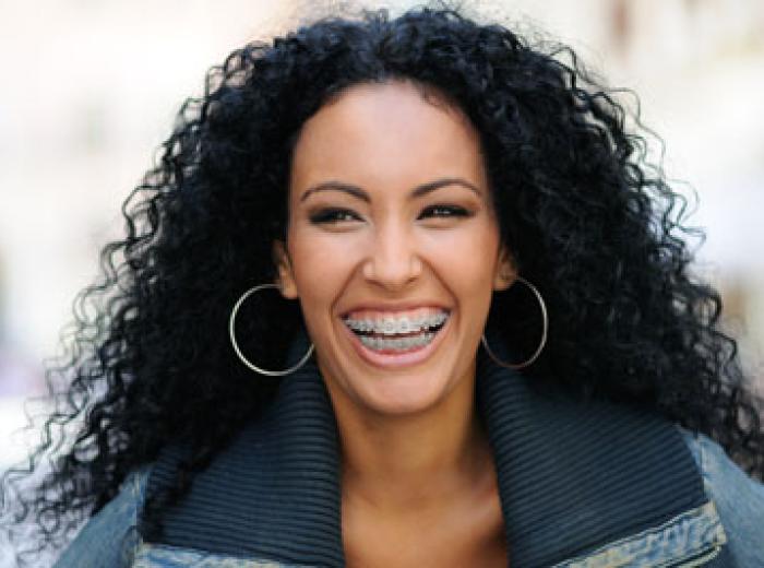 Transform Your Smile with Adult Orthodontics in Jenkintown