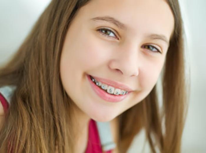 Signs You Need Orthodontics Treatment in Jenkintown