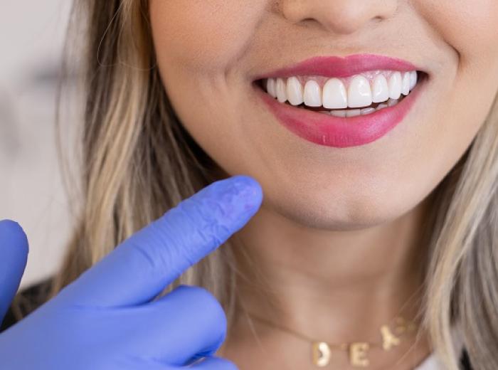 3 Essential Questions for Choosing a Restorative Dentist