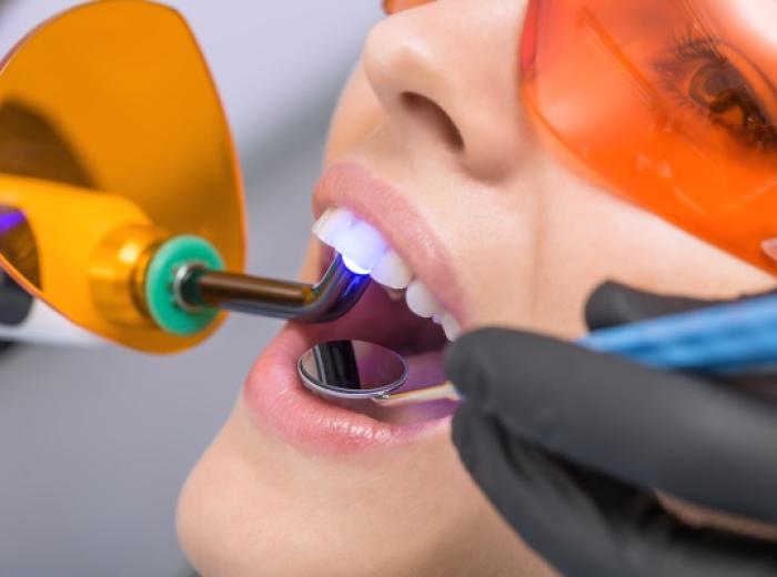 Teeth Whitening Tips: Make It Last in Jenkintown