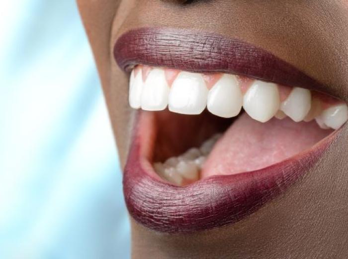 Smile Makeover Options in Jenkintown