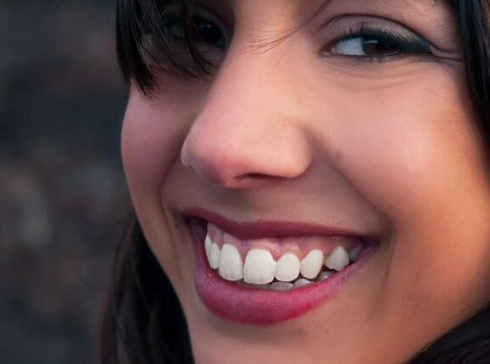 Gummy Smile Treatment: Everything You Need to Know