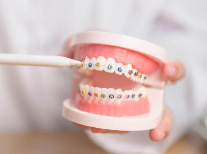Transform Your Smile: A Comprehensive Look at Orthodontic Care